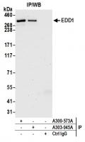 Detection of human EDD1 by western blot