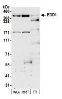 Detection of human and mouse EDD1 by wes
