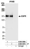 Detection of human EGFR by western blot