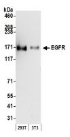 Detection of human and mouse EGFR by wes