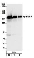 Detection of human EGFR by western blot.