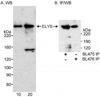 Detection of human ELYS by western blot