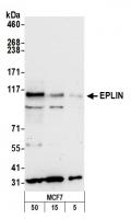 Detection of human EPLIN by western blot