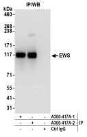 Detection of human EWS by western blot o