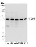 Detection of human and mouse EWS by west