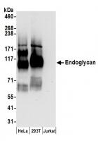 Detection of human Endoglycan by western