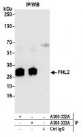 Detection of human FHL2 by western blot