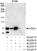 Detection of human FIGNL1 by western blo