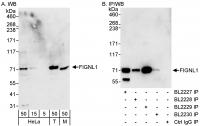 Detection of human and mouse FIGNL1 by W