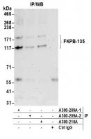 Detection of human FKPB-135 by western b