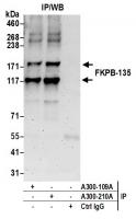 Detection of human FKPB-135 by western b