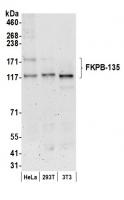 Detection of human and mouse FKPB-135 by