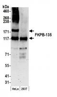 Detection of human FKPB-135 by western b
