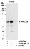 Detection of human FOXO3a by western blo