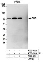 Detection of human FUS by western blot o
