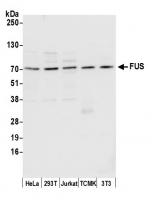 Detection of human and mouse FUS by west