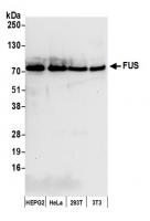 Detection of human and mouse FUS by west