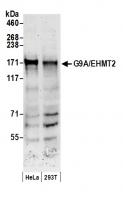 Detection of human G9A/EHMT2 by western