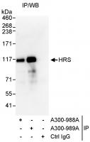 Detection of human HRS by western blot o