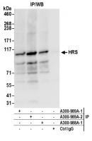 Detection of human HRS by western blot o