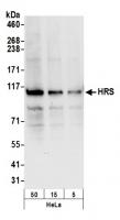 Detection of human HRS by western blot.
