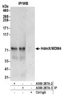 Detection of human HdmX/MDM4 by western