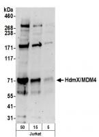 Detection of human HdmX/MDM4 by western