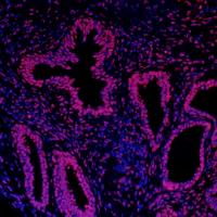Detection of human Histone H3 by immunoh