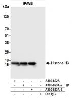 Detection of human Histone H3 by western