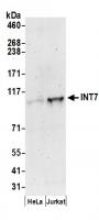 Detection of human INT7 by western blot.