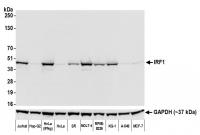 Detection of human IRF1 by western blot.