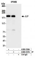 Detection of human JLP by western blot o