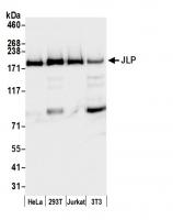 Detection of human and mouse JLP by west