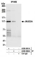 Detection of human JMJD2A by western blo