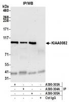 Detection of human KIAA0082 by western b