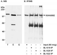 Detection of human KIAA0082 by western b