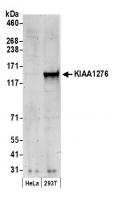 Detection of human KIAA1276 by western b