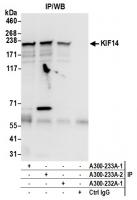 Detection of human KIF14 by western blot