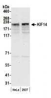 Detection of human KIF14 by western blot