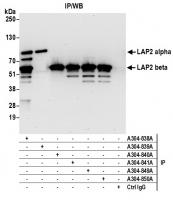 Detection of human LAP2 alpha and beta b