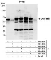 Detection of human LAP2 beta by western