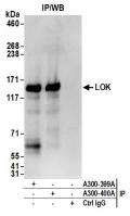 Detection of human LOK by western blot o