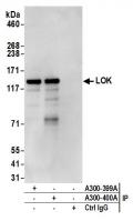 Detection of human LOK by western blot o