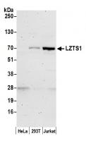 Detection of human LZTS1 by western blot