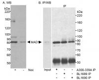 Detection of human MAD1 by western blot
