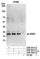 Detection of human MAD2 by western blot