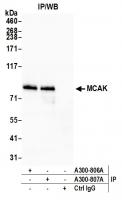 Detection of human MCAK by western blot