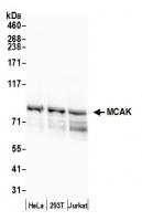 Detection of human MCAK by western blot.