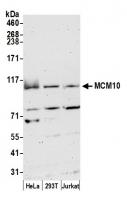 Detection of human MCM10 by western blot