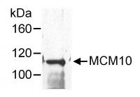 Detection of human MCM10 by western blot